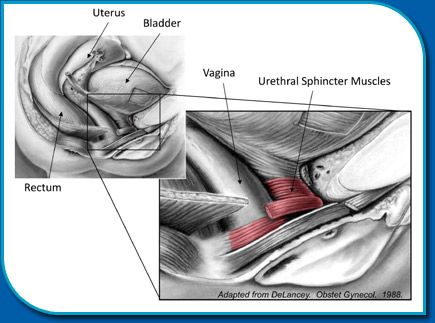 Urinary Incontinence - AARE UROCARE - Female Urology