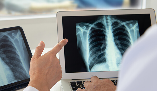 Providers reviewing x-rays.