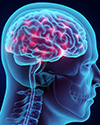 Trigeminal Neuralgia Video thumb image