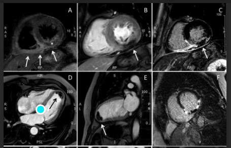 Medical imagery. 