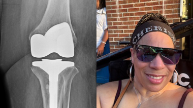 MSKI Patient Story June Joints Feature_thumb