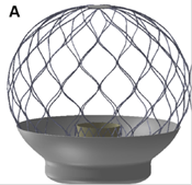 trans-catheter Mitral Valve Replacement (TMVR) technology