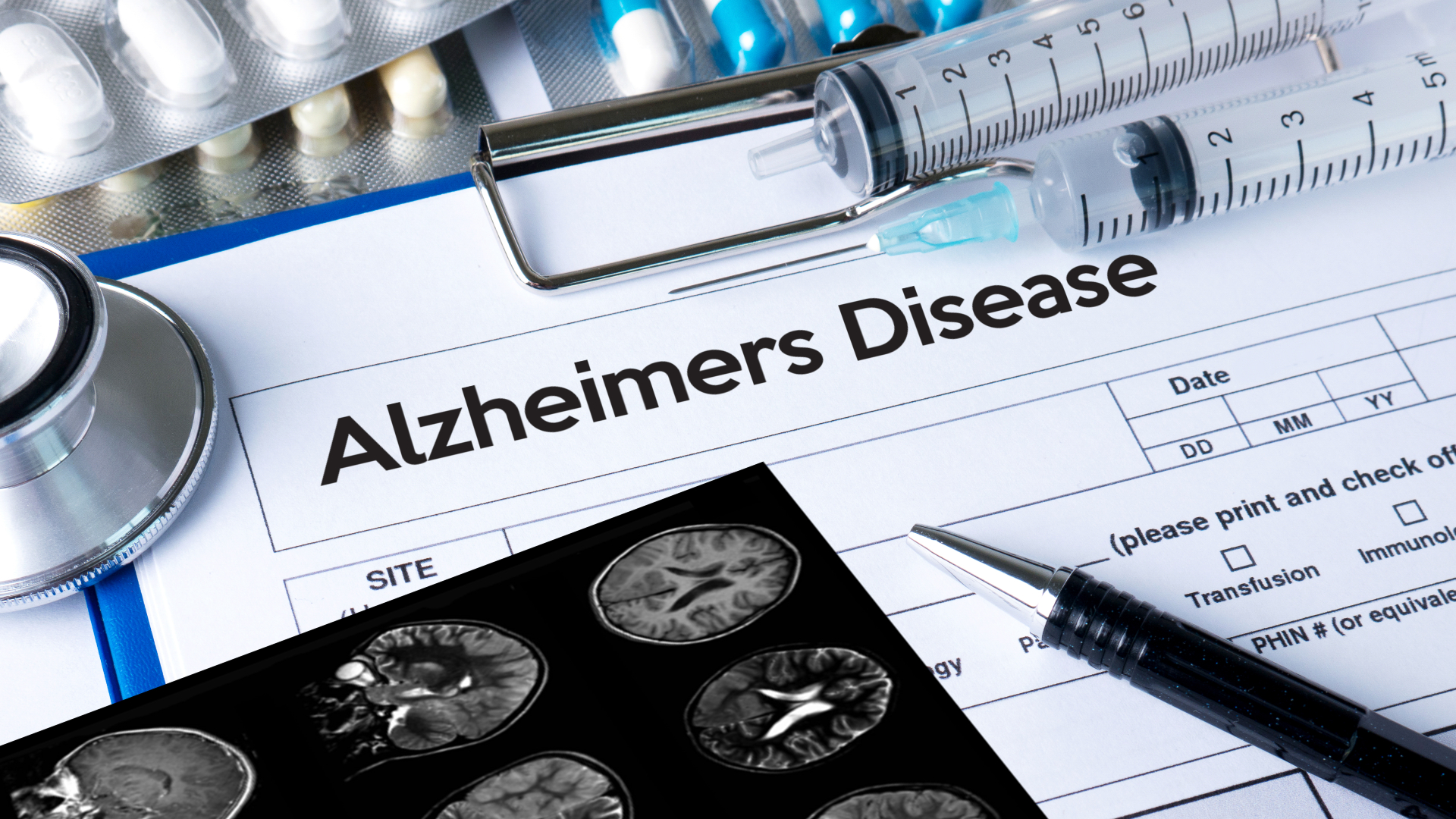 Atrium Health is responding to the new, controversial FDA-approved Alzheimer’s drug with statements from experts across service lines.