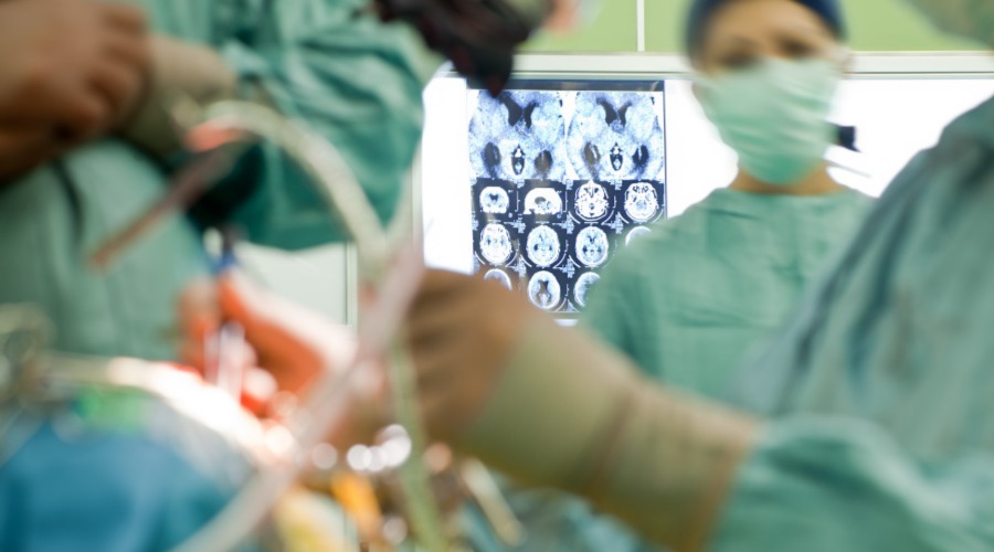 Doctors performing brain surgery.