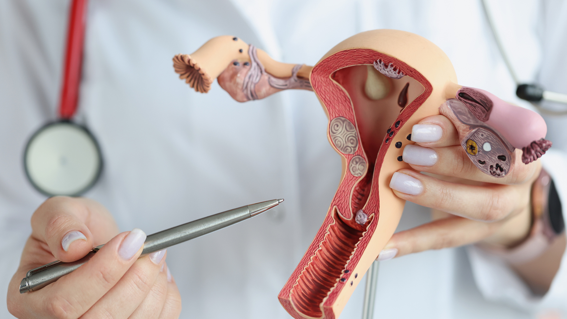 Atrium Health Levine Cancer Institute Offers New Clinical Trials for Ovarian Cancer