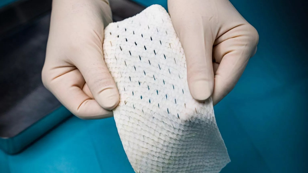 Atrium Health's Sanger Heart & Vascular Institute First in the World to use  Implantable Fish-Skin Grafting in Reconstructive Surgery