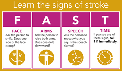 FAST stroke symptoms