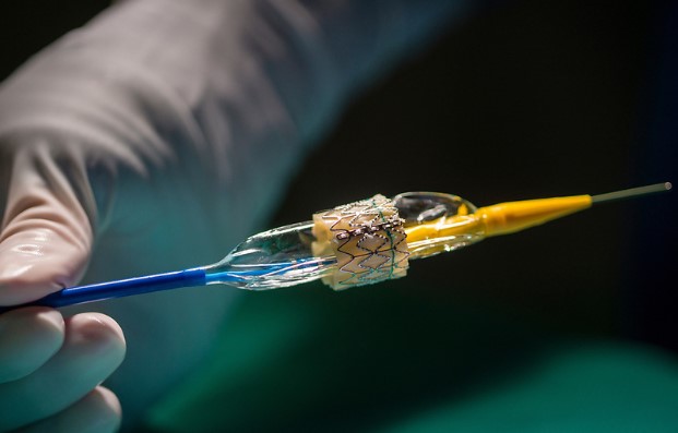 Heart Surgery Alternative