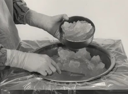 Kidney stone removal