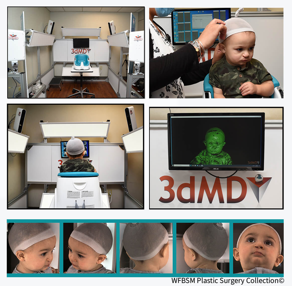 A graphic featuring images of children undergoing the 3DMD process and equipment used in said process.
