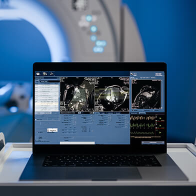 A computer showing screening results from an MRI machine in the background.