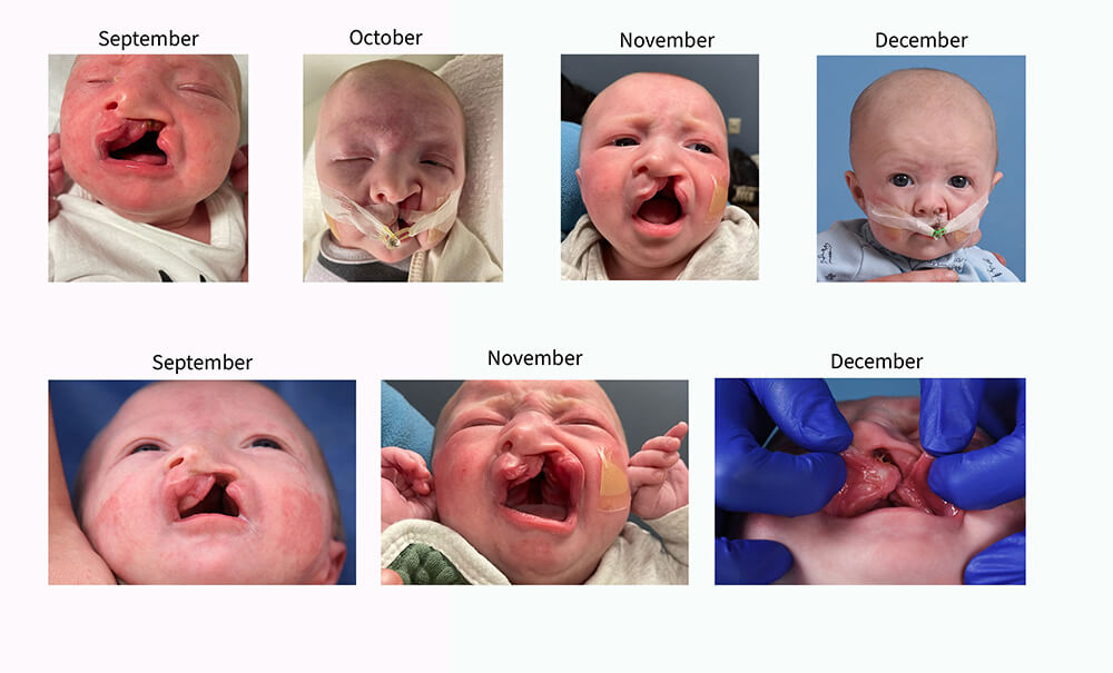 A month-by-month timeline for NAM treatment.