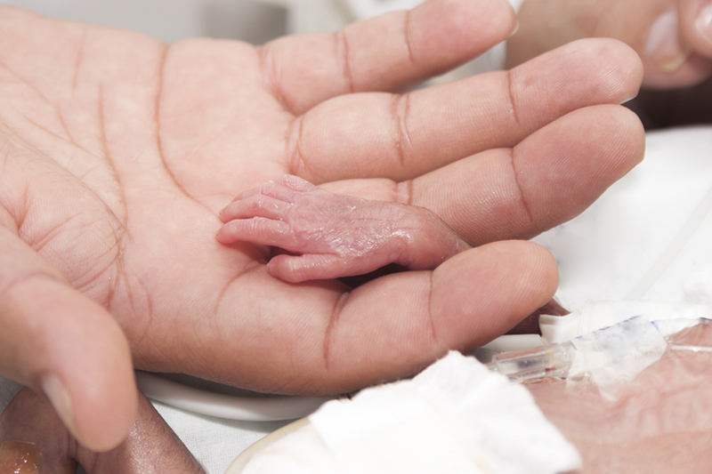 Premature baby's hand in an adult's hand