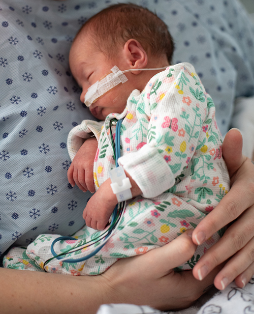 Premature newborn with feeding tube in nose and wearing a floral onesie is cuddled upright against a woman's chest