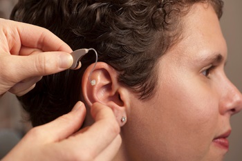 Placing a hearing aid in patient's ear