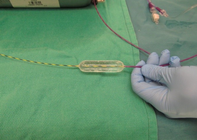 Tools used during an esophageal dilation. 