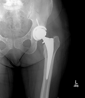 Cynthia West After X-Ray