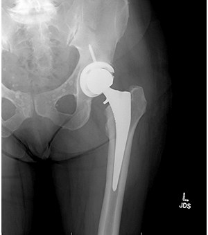 Cynthia West After X-Ray