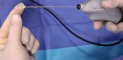 Wake Forest Baptist First in Region to Offer Micro-arthroscopy System