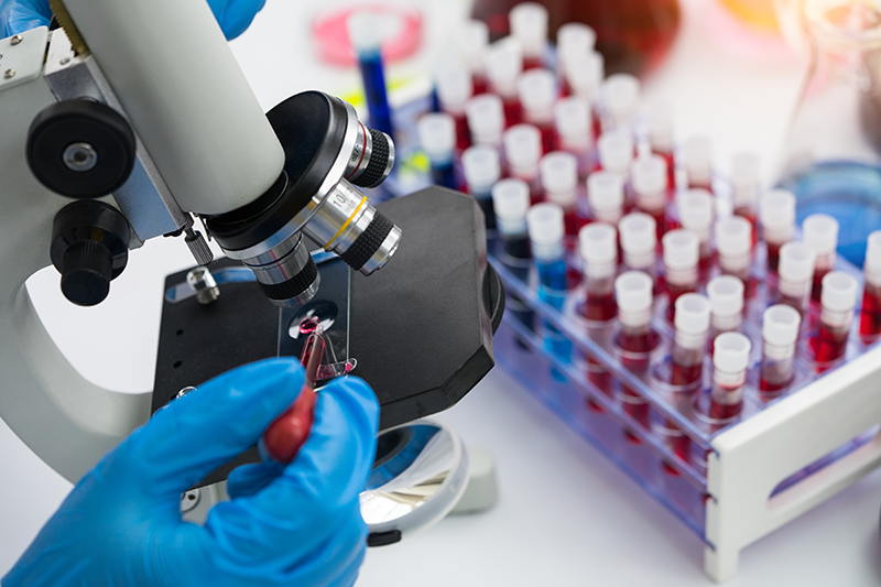 Blue-gloved hand puts substance on a slide of a microscope; tray of vials with red liquid sits on counter