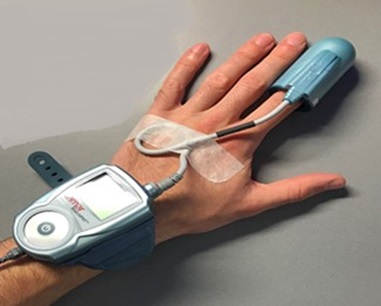 A male hand splays on a flat surface, with a pulse oxygenation device over the pointer finger and a tube running from that to a flat device on the back of the hand near the wrist