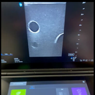 Sonosite PX