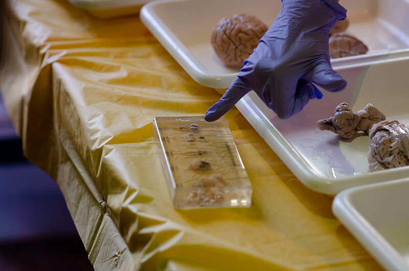 Person pointing to display of brains.