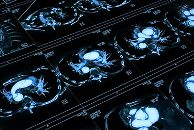 Rows of blue-gray images of an internal body part or organ line up on a black background (like a series of x-rays)