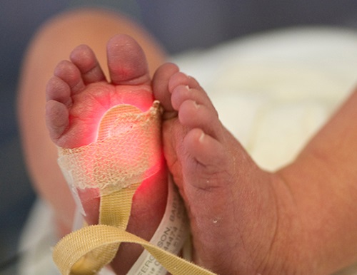 Close-up of newborn's feet with glowing red pulse oxygen monitor taped to it