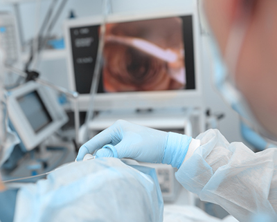 Slightly blurry image of brochoscopy procedure