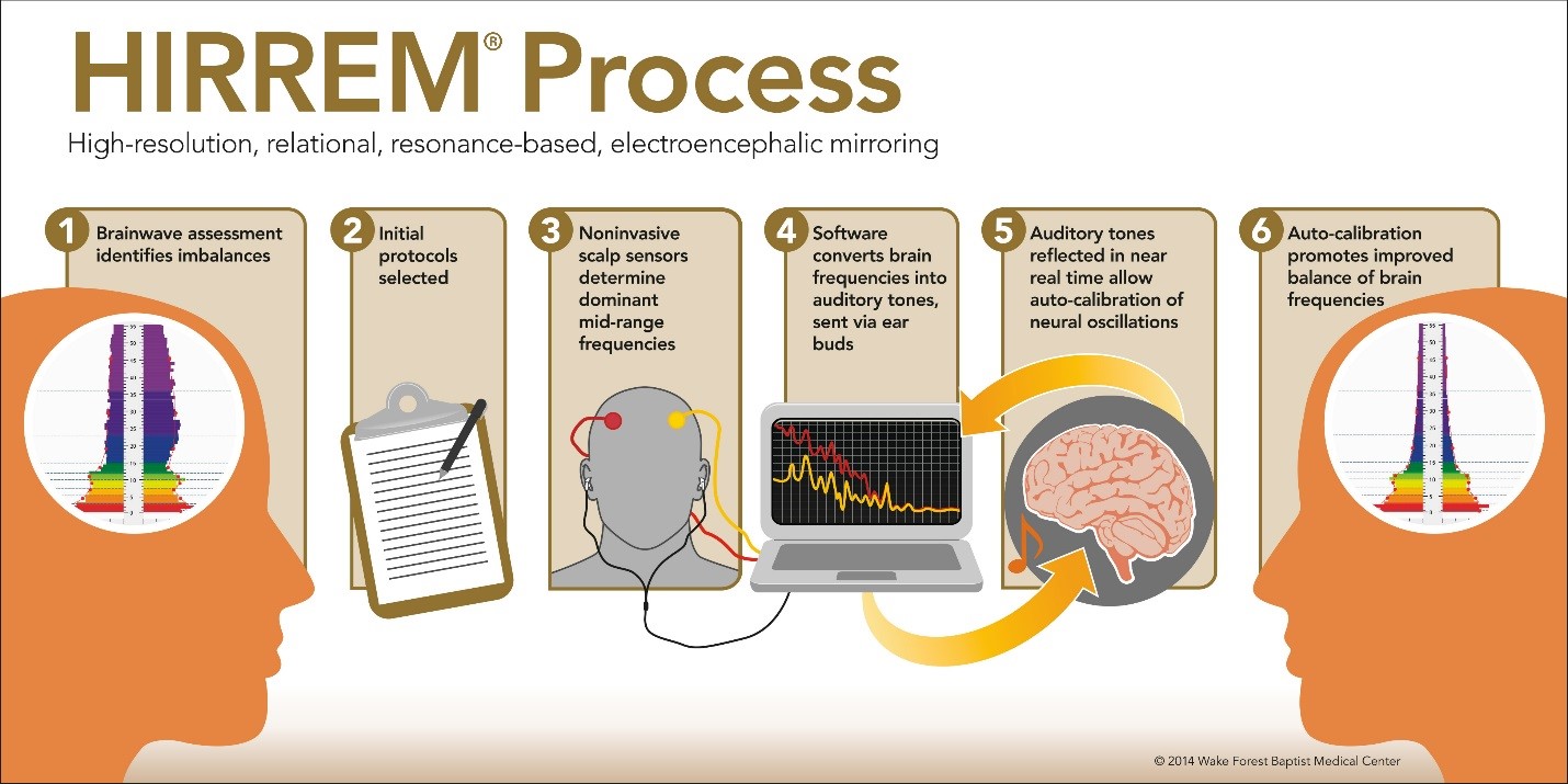 HIRREM Process