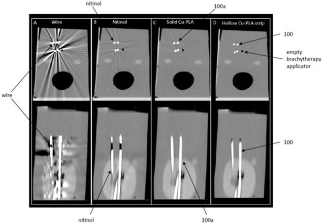 Cross-sectional and side views of CT images comparing CT imaging artifacts generated by commercially available contrast markers and the 3D-printed contrast markers.