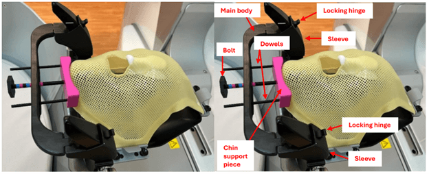 The PARCS device attaches to the Elekta mask adapter and provides support to the patient's chin, preventing head rotation.