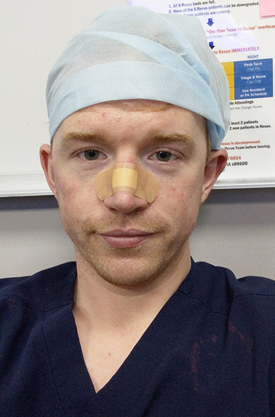 A white man in navy scrubs and head covering looks into the camera, a bandage across the bridge of his nose