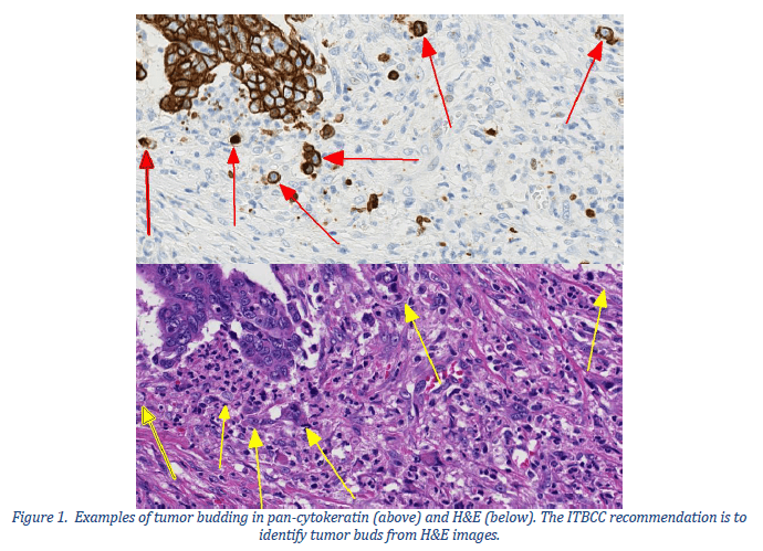 Hematoxylin and eosin stain