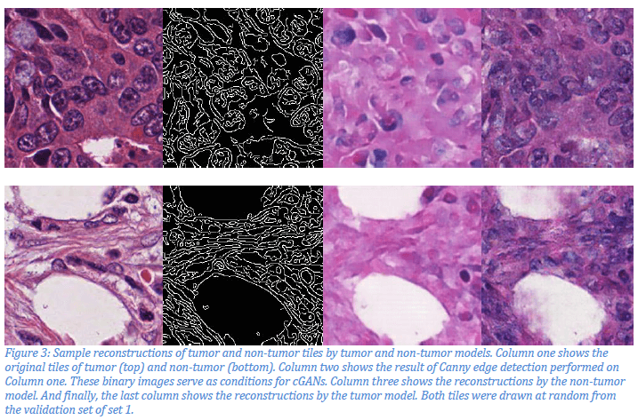 Hematoxylin and eosin stain 