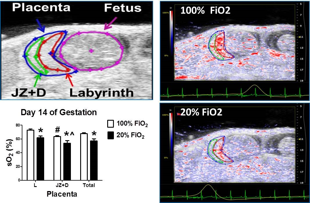 Photoacoustic Imaging of Tissue Hypoxia