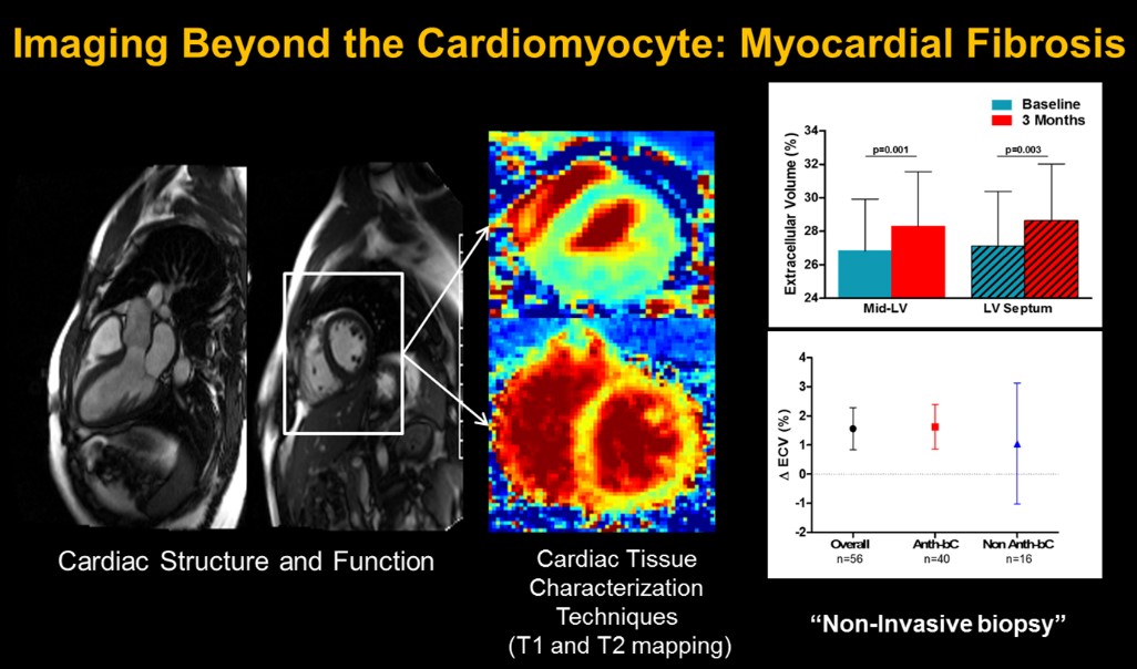 Cardiomyocyte - Melendez Lab