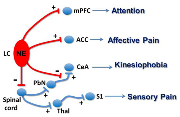 Diagram consisting of red oval with four branches, seven blue circles (some connected) that represents four kinds of pain