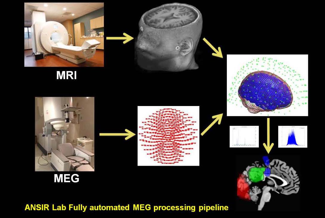 Wake Forest RIIPL MEG pipeline