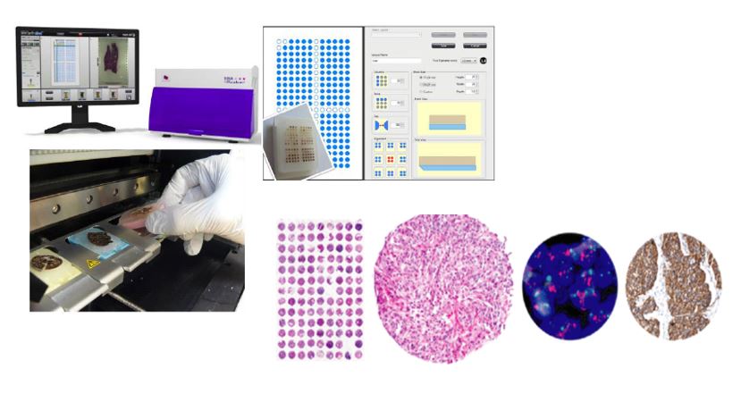 Tissue Microarrays Shared Resources