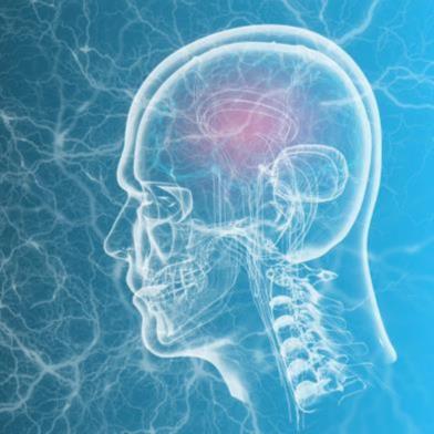  CUPID Research: Finding Faster Ways to Pinpoint the Deadliest Strokes