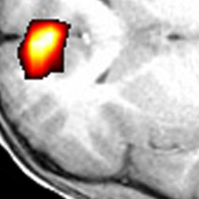 Neuroscience (PhD and MS)