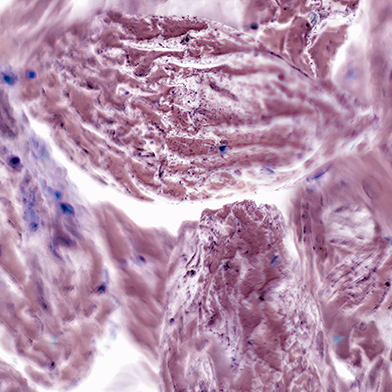 Translational Oncology Training Program