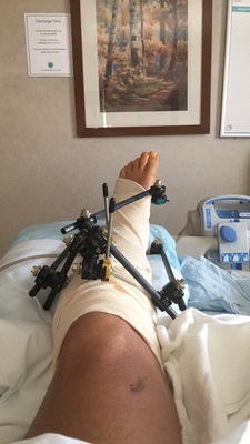 Incredible Resilience as One Man Overcomes Seven Surgeries in Seven Days After Motorcycle Crash