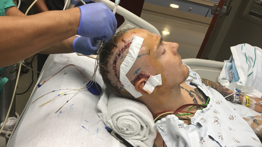 Scott Anderson after epilepsy surgery