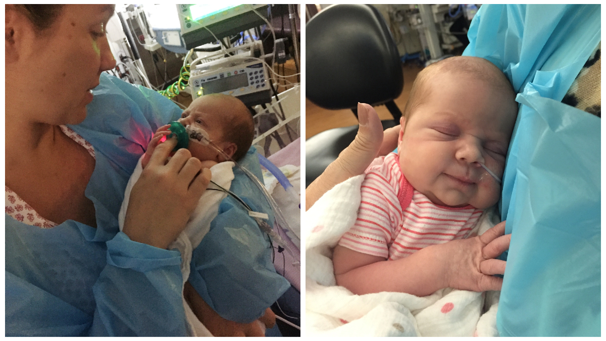 Daily Dose - Smallest Baby Born at Levine Children's Hospital Now Thriving