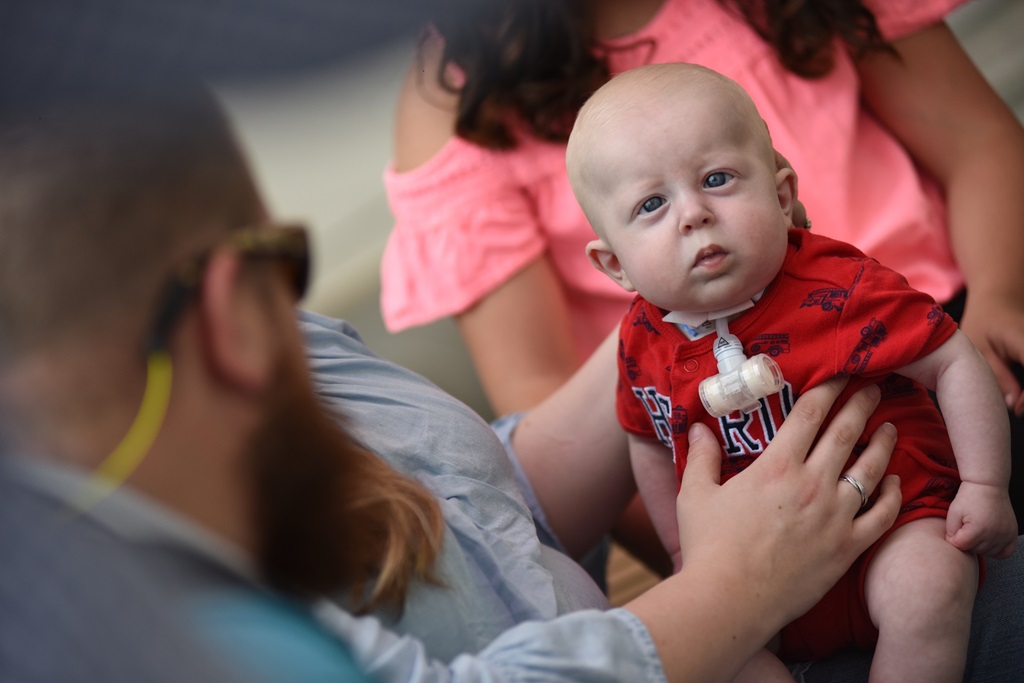 baby Colt heads home after a successful tracheostomy