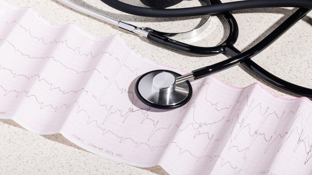 A stethoscope resting on a long sheet of notes on a table.