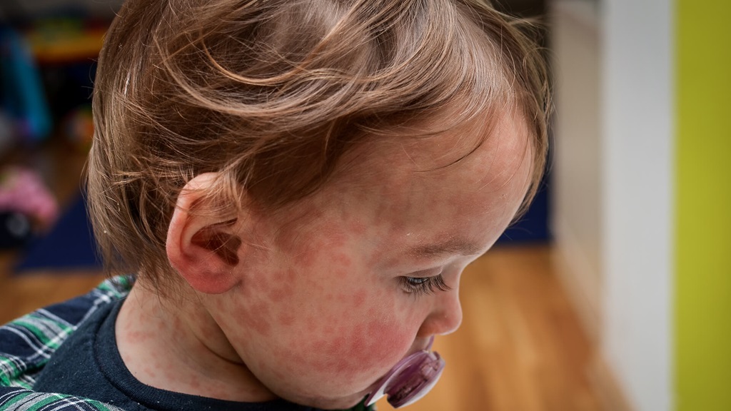 A sick young boy sitting in a medical office.